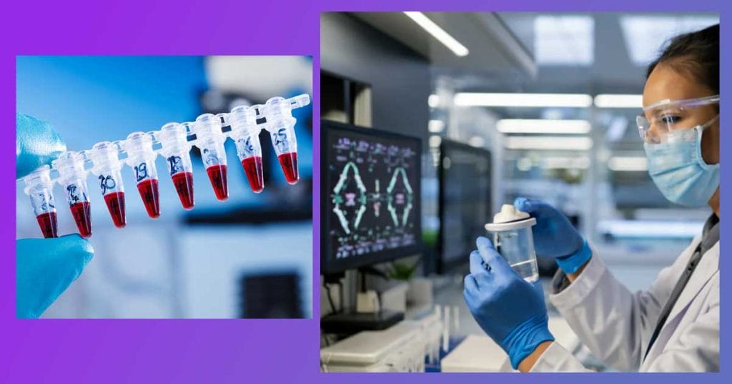 Дали сте любопитни какво може да разкрие съвременният ДНК тест по време на бременността?